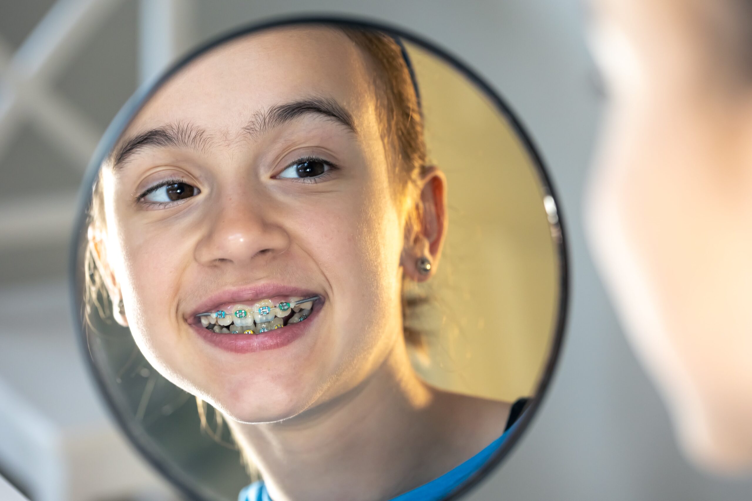 Copilul tău are nevoie de aparat dentar? Află când și cum să începi tratamentul