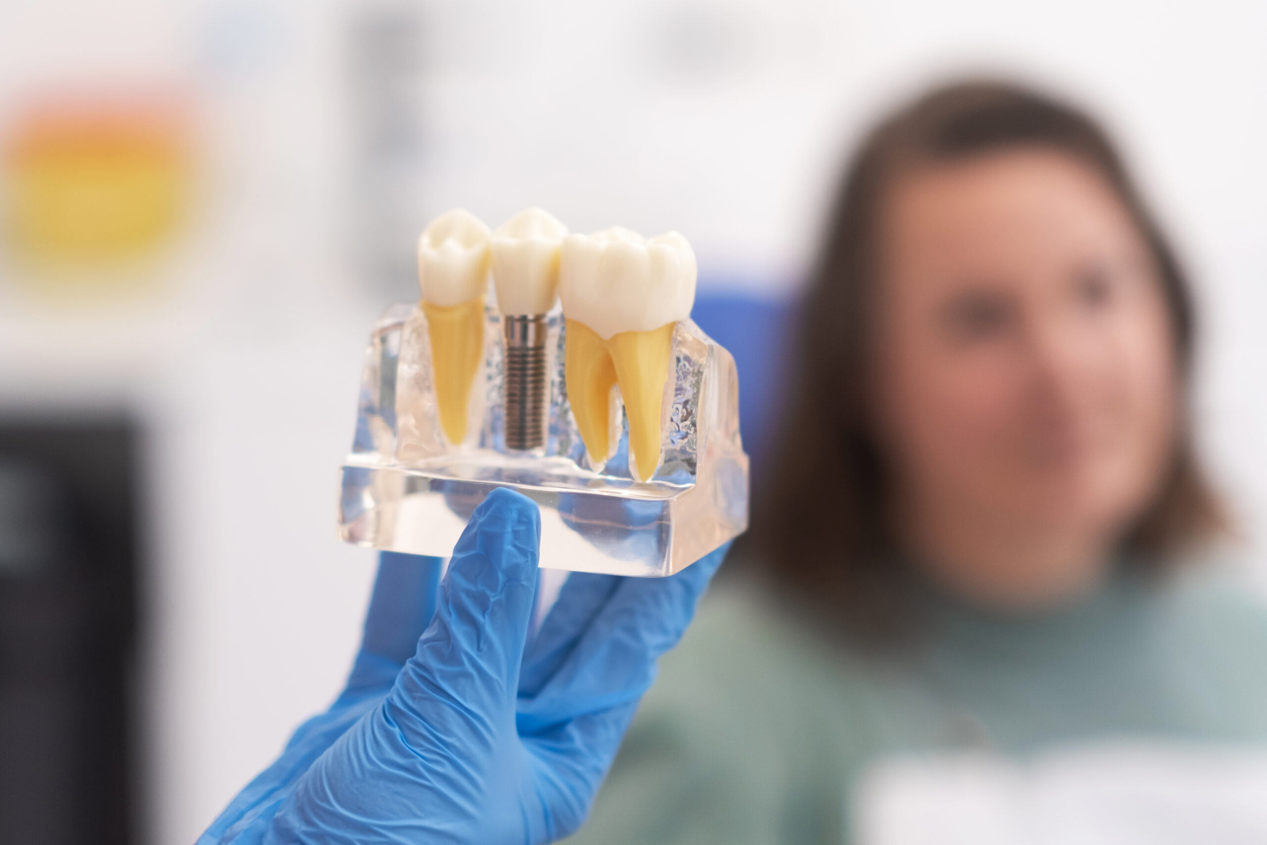 Durerea în timpul implantului dentar – Mit sau realitate?