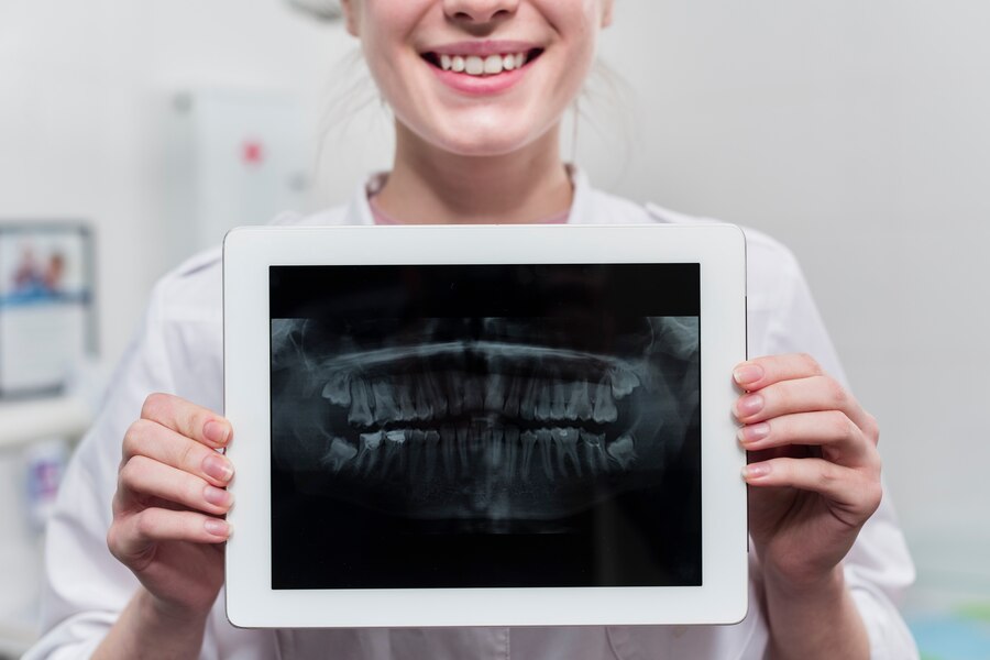 Radiografia dentară explicată: Ce înseamnă fiecare detaliu pentru medic