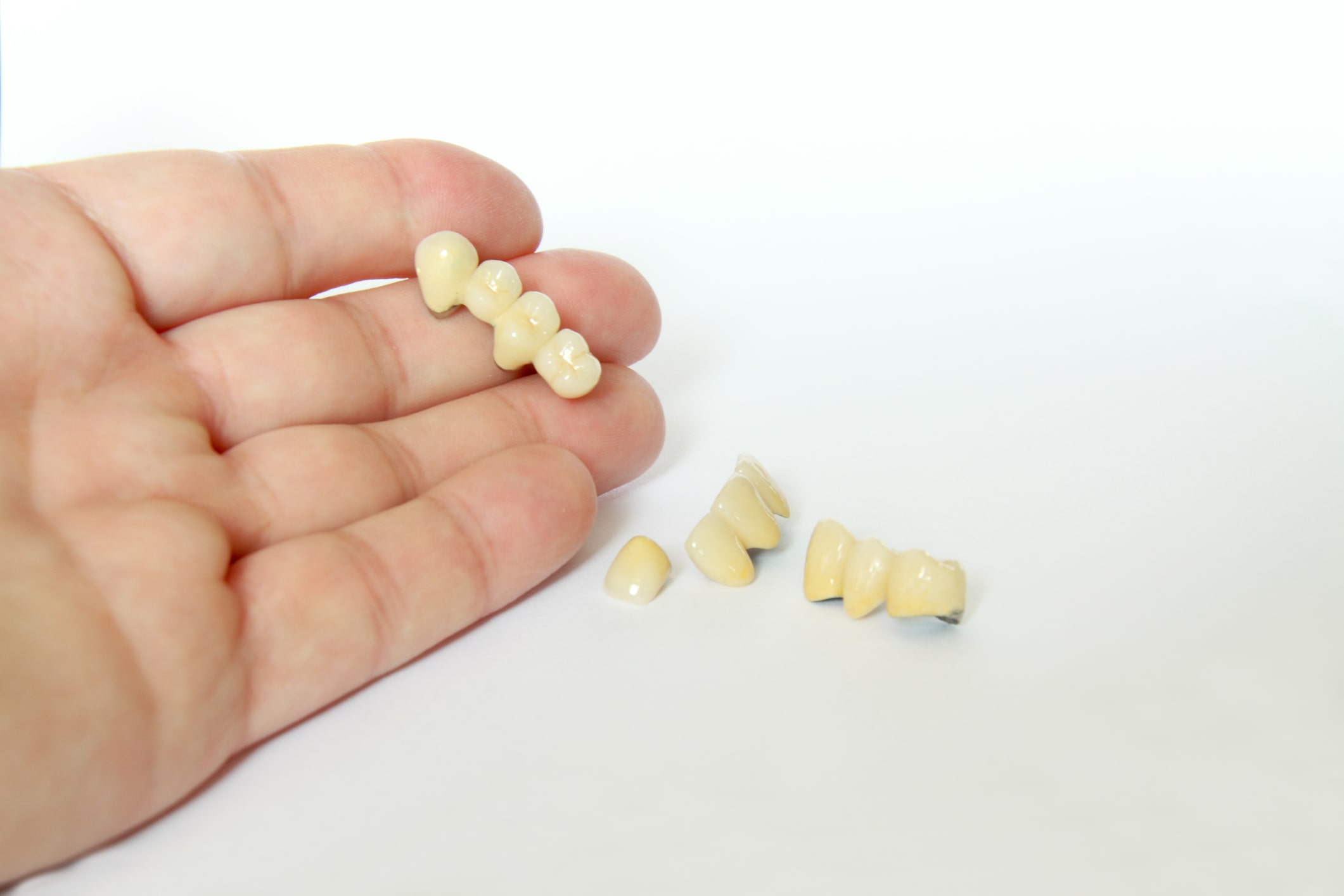 Punte dentară uzată? Iată când trebuie schimbată